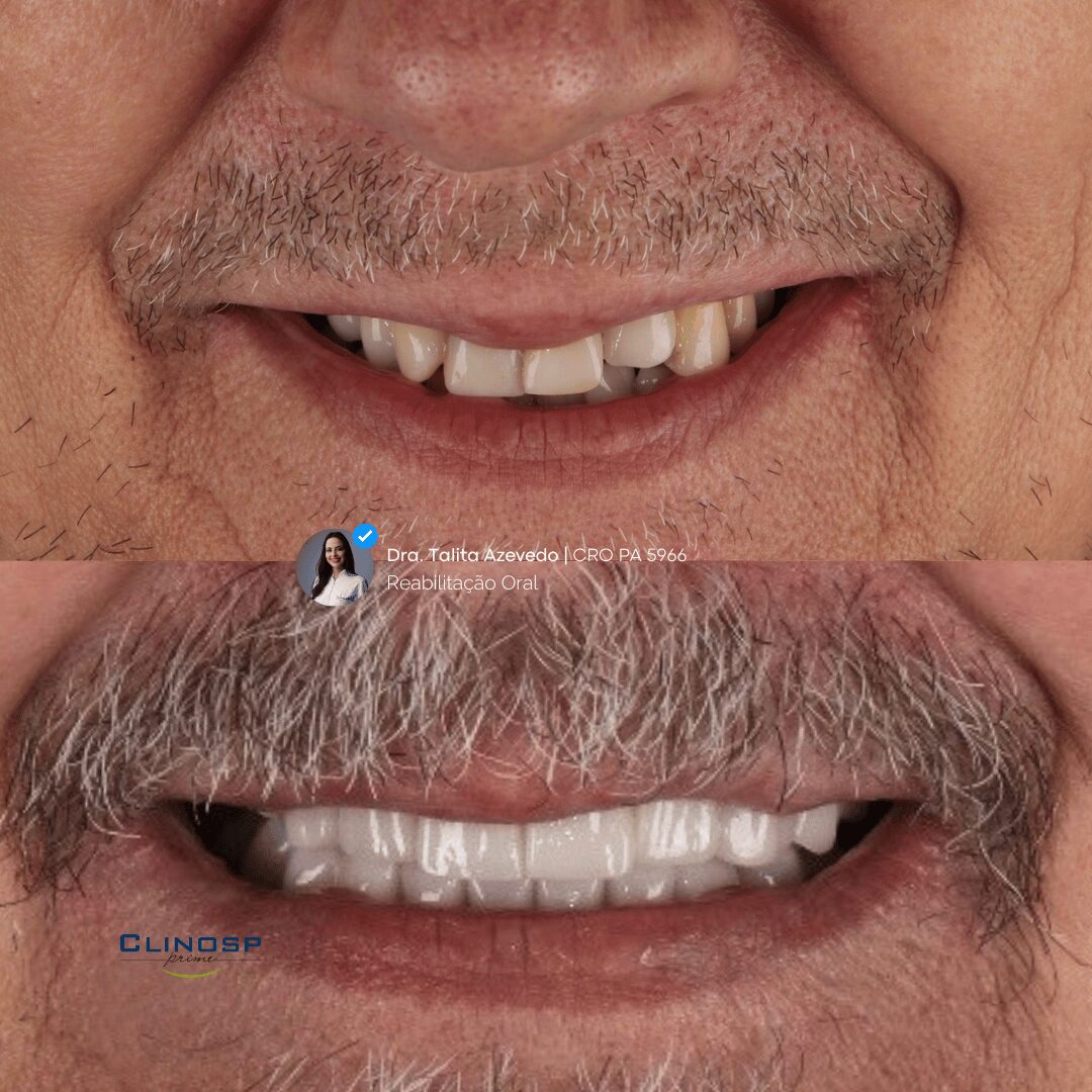 PAISAGEM - ANTES E DEPOIS FACETAS 2